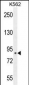 CLIC6 Antibody (Center)